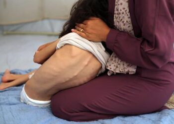 خسائر فادحة بين المدنيين في غزة، وسرقة أغذية علاجية مخصصة للأطفال الجوعى